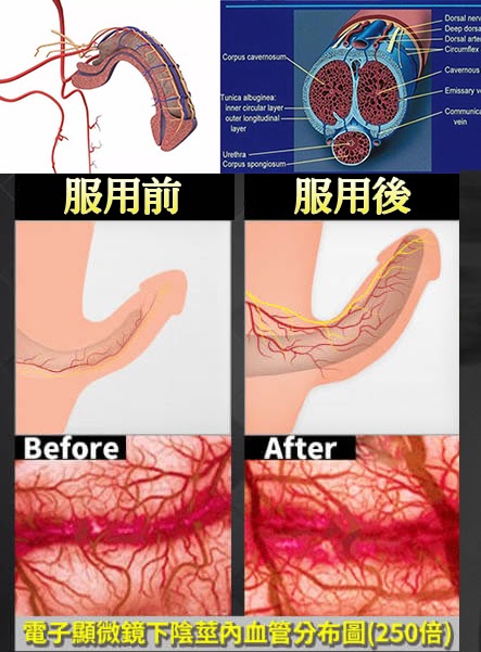 示意圖片一